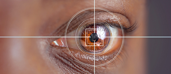 scei-glaucoma-surgery-selective-laser-trabeculoplasty-slt